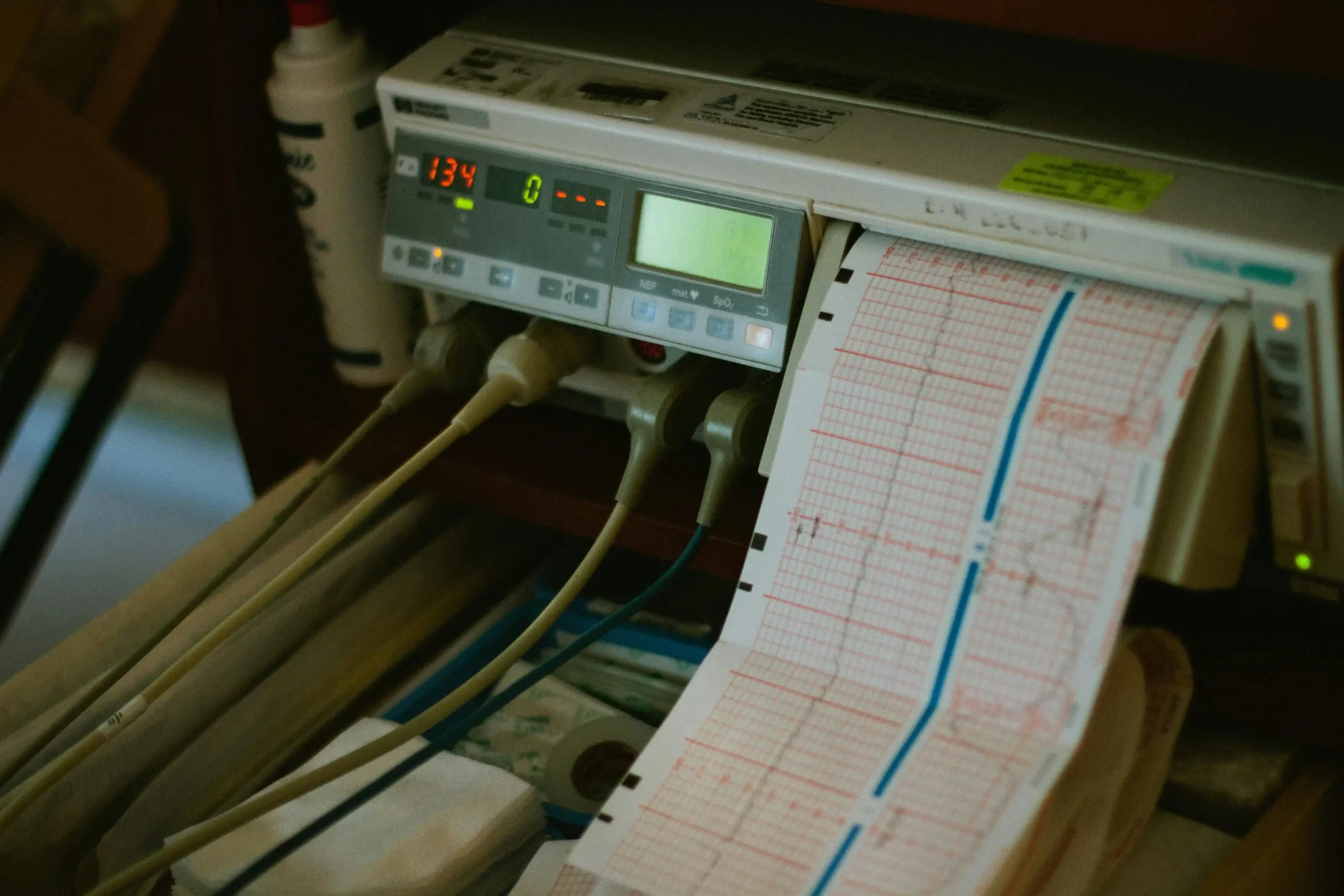 A electronic fetal heart rate monitor printing a paper graph readout with digital numerical displays lit up.