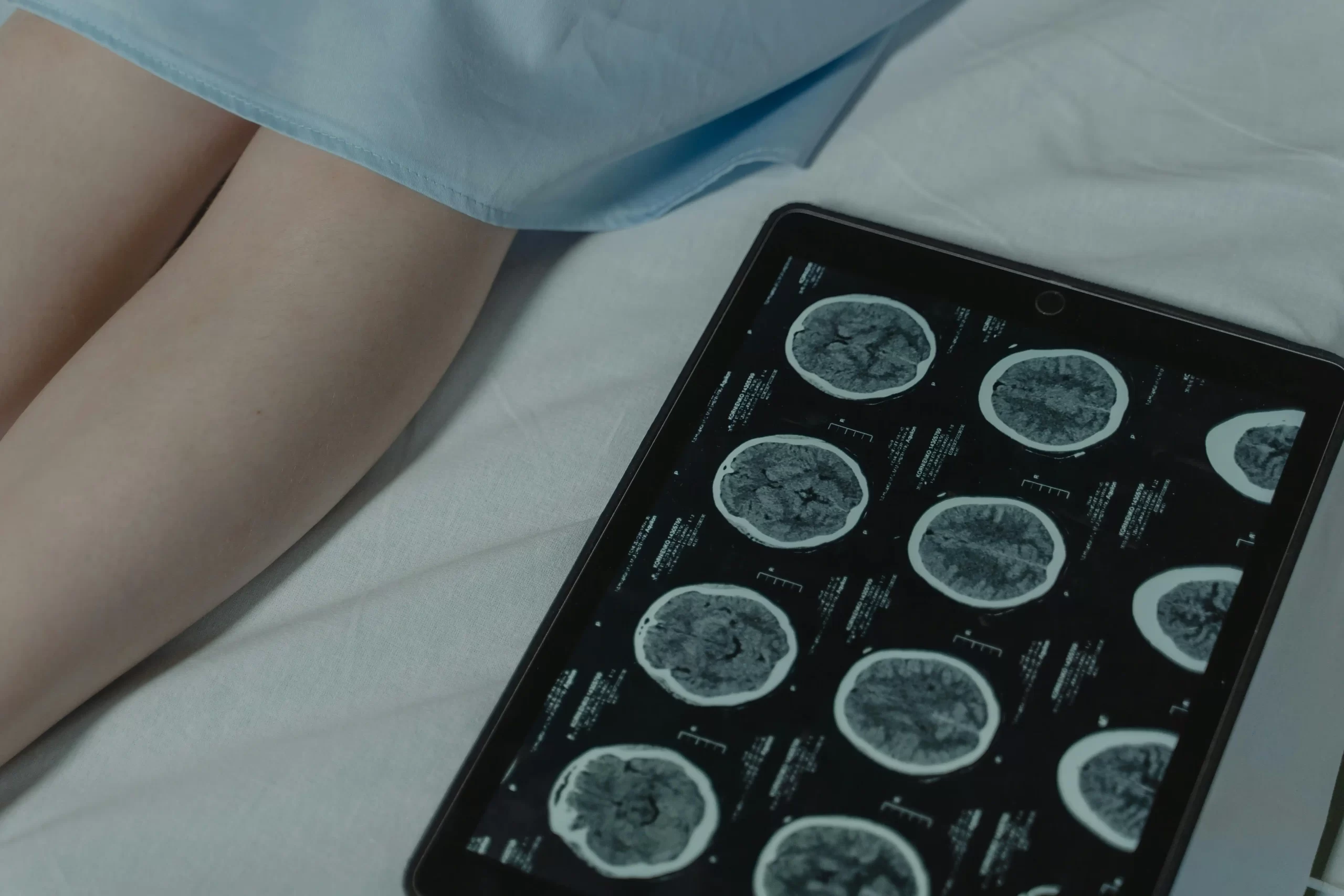 A tablet computer lying on a hospital bed displaying brain CT scan or MRI results next to a patient.